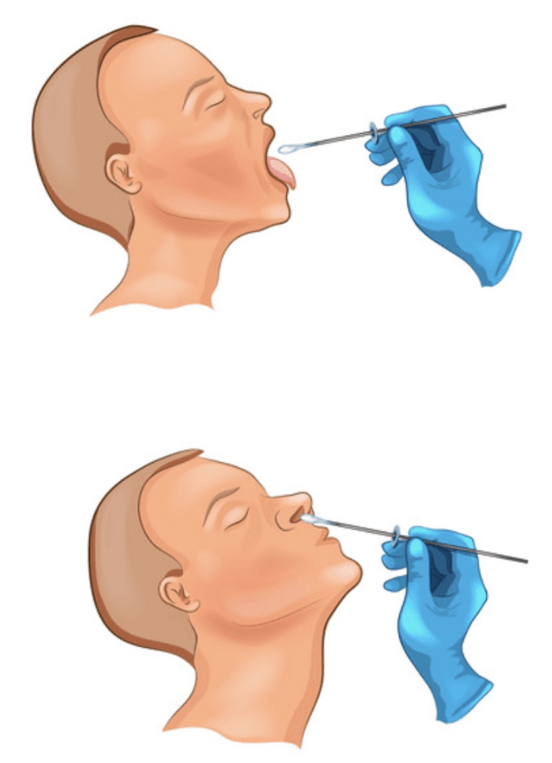 test corona virus pikilidou